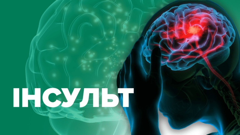 Що таке інсульт та як його розпізнати?