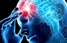 Що таке інсульт та як його розпізнати?